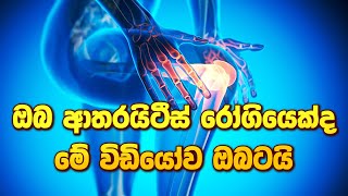 ඔබ ආතරයිටීස් රෝගියෙක්ද මේ විඩියෝව ඔබටයි ayurveda arthritistreatment arthritis [upl. by Neill]