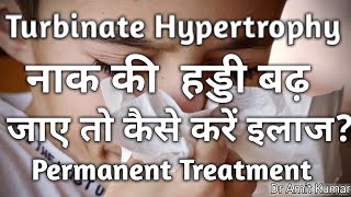 Turbinate Hypertrophy नाक की हड्डी बढ़ना । [upl. by Tesler625]