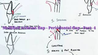 What is Periodontal Surgery  An Insightful Look into Dental Procedures  Oral Health Series [upl. by Hepsoj]