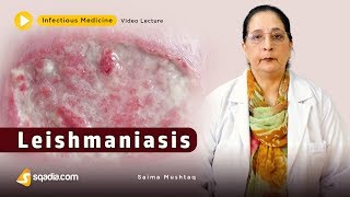 Leishmaniasis  Infectious Clinical Medicine Video  VLearning  sqadiacom [upl. by Ahcim]