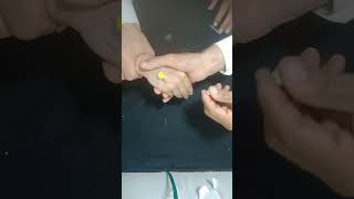 Intravenous Cannulation Procedure baby cannula ivcannulation Access IV cannula [upl. by Eiralav]