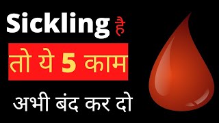 sickling है तो ये 5 काम अभी बंद कर दोSickle cell anemia [upl. by Cower]