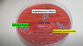 Staphylococcus lentus Klebsiella pneumoniae and Serratia ficaria on CLED Agar of Urine Culture [upl. by Adnohser]