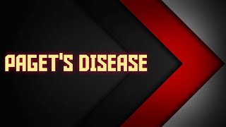 PAGETS DISEASE  FIBROOSSEOUS LESIONS [upl. by Galatia]