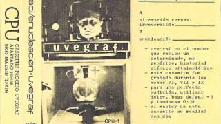 Uvegraf  Enucleación excerpt [upl. by Ahsenid]