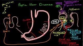 Peptic Ulcer Disease Pathophysiology [upl. by Enidan931]