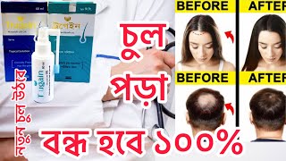 চুল পড়া বন্ধ হবে ১০০  Trugain52ব্যবহার করলে নতুন চুল গজাবে আপনারও Trugain সম্পর্কে বিস্তারিত [upl. by Atnahsal]