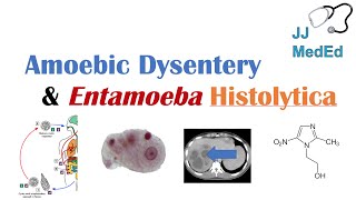 Amebiasis Amoebic Dysentery  Entamoeba histolytica Pathogenesis Signs amp Symptoms Treatment [upl. by Hcaz6]