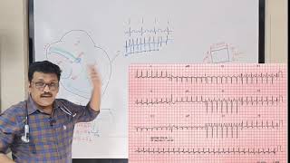 ECG MADE EASY FOR UNDERGRADUATES [upl. by Collie813]