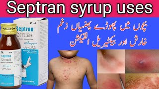 Septran syrup uses in Urduseptran syrupbacterial infection co trimoxazole [upl. by Kermit846]