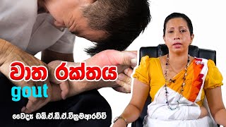 වාත රක්තය l watha rakthaya  ayurvedic treatment  Dr Asoka Wickkramaarachchi [upl. by Larret]