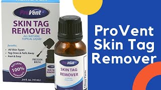 ProVent Skin Tag Remover [upl. by Lukey570]