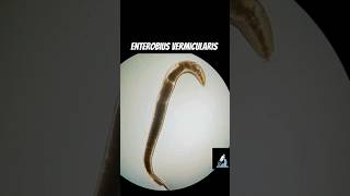 Enterobius vermicularis  Pinworm and its eggs [upl. by Carena]