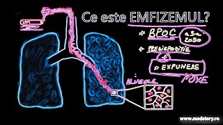 Ce este emfizemul pulmonar Ilustrație [upl. by Charmion]