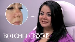 Lipo Patient Gets Surprise Piggy Nose Instead  Botched Recap S5 E10  E [upl. by Aracal375]