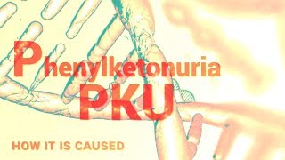 Phenylketonuria  PKU  Mental Retardation  Phenylalanine Hydroxylase [upl. by Gaye]