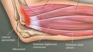 Lateral Epicondylitis tennis elbow exercise [upl. by Mistrot]