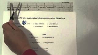 EKG für Pflege Teil 10  Sinusrhythmus interpretieren [upl. by Brandon591]