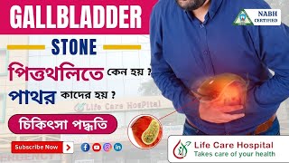 Gallstones Causes and Prevention  Dr A Rahaman [upl. by Louanne547]