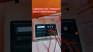 Capsulitis Pain Treatment Use of TENS Mechine physiotherapy forzensoulder viralvideo shorts [upl. by Hsihsa141]