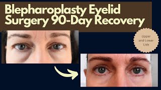 Eyelid surgery blepharoplasy 90day recovery with day by day before and after photos [upl. by Eire]