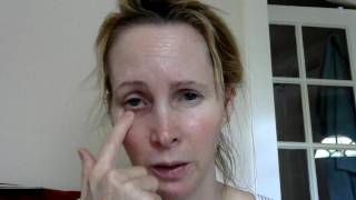 How to massage your tear ducts to unblock dry or watery eyes [upl. by Roxy]