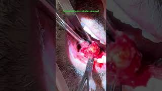 Removal of submandibular gland calculus under local anesthesia [upl. by Mcclary]