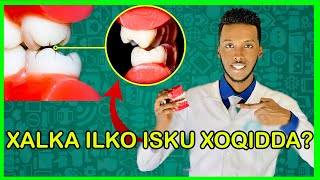 ILKO JIRIRQSIGA🦷 IYO SIDA LA ISAGA JOOJIYO  BRUXISM [upl. by Narah]