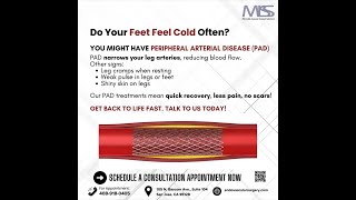 Feet Feel Cold Often You Could Have Peripheral Artery Disease [upl. by Steep]