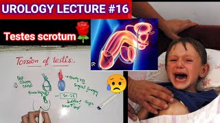 Urology surgery lecture 16 torsion of testis testicular appendages orchitis [upl. by Ellehcer]