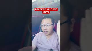 Bintitan Infeksi kelopak mata bintitan sakit mataminus mata kesehatan reynaldsusilo [upl. by Safir557]