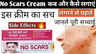 No Scars Cream कब लगाए और कब लगाना बंद करे No Scars क्रीम Uses  No Scars Cream side effects [upl. by Ahsennek]