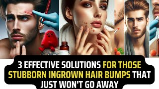 Top Best Effective Solutions for Stubborn Ingrown Hair Bumps That Won’t Go Away [upl. by Alyos]