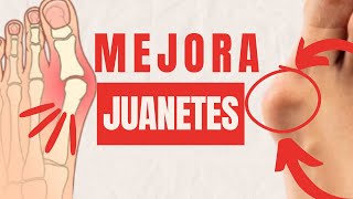 ¿JUANETES Mejóralos con estos ejercicios [upl. by Eiramassenav]