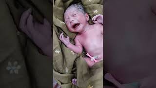 Newborn baby immediately after birth first look shorts [upl. by Aenit]