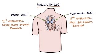 Heart Murmurs and Heart Sounds Visual Explanation for Students [upl. by Nirtak]