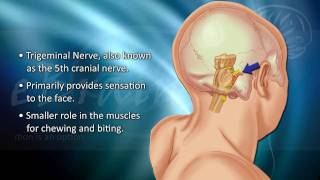 Understanding Trigeminal Neuralgia  eBrainMDcom [upl. by Nosreffej]