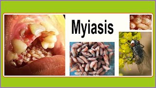 myiasis [upl. by Myrilla183]