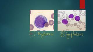 Myeloblast vs Lymphoblast mnemonic [upl. by Bille]