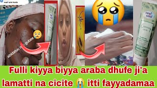 Fulli kiyya biyya arabatti dhufe jia lamatti na cicite itti fayyadamas😭 [upl. by Ococ962]