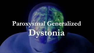 Dr Kukurin Paroxysmal Generalized Dystonia [upl. by Bedad]