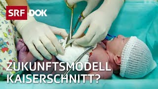 Kaiserschnitt  Die Geburt der Zukunft  Doku  SRF Dok [upl. by Craven]