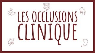 Sémiologie Chirurgicale  Diagnostic Clinique des Occlusions [upl. by Giorgi]