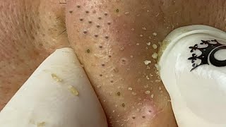 Satisfying Relaxing with Sac Dep Spa Video 127 [upl. by Dulcia]