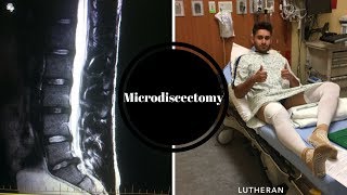 Microdiscectomy 1 Day Post Surgery L5S1 [upl. by Enyamrahs]