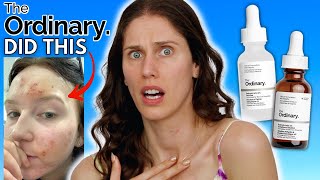 WHAT HAPPENED TO THE ORDINARYS SALICYLIC ACID VS THE NEW SALICYLIC ACID ANHYDROUS SOLUTION [upl. by Orsa]