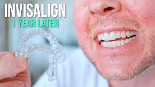 10 Things I Wish I Knew BEFORE Getting Invisalign [upl. by Pizor]