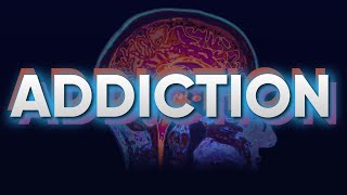 The Science of Addiction and The Brain [upl. by Dranyar508]