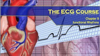 The ECG Course  Junctional Rhythms [upl. by Remoh517]