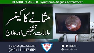 BLADDER CANCER  مثانے کا کینسر [upl. by Akers595]